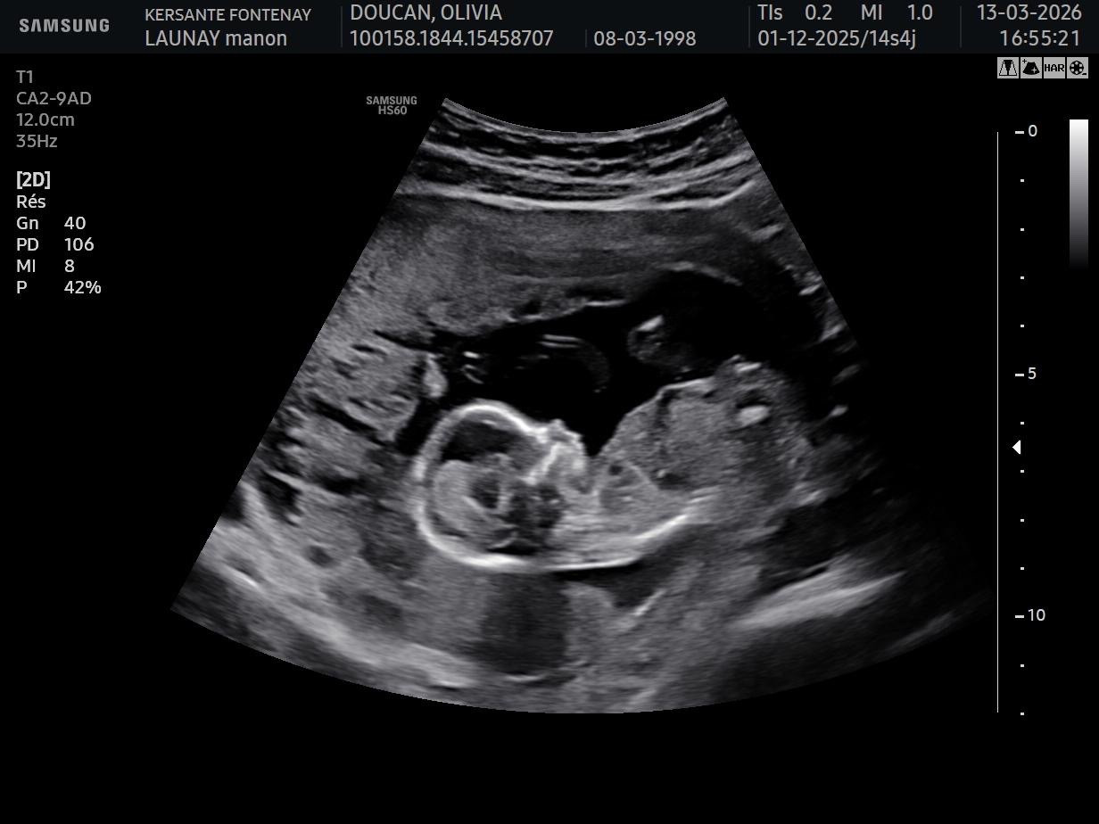 Infos importantes chez Les Golden d Or